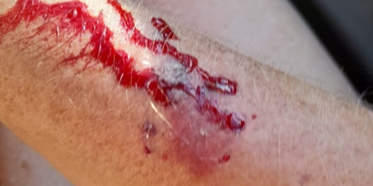 DAÑO. La rescatista pidió responsabilidad en la tenencia de las mascotas./ Foto gentileza K. Welter