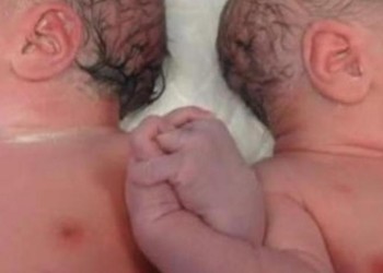 Mellizos recién nacidos fueron abandonados por su mamá en Neo