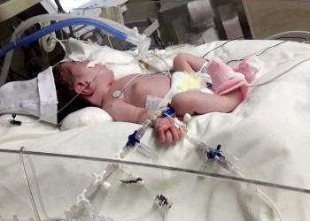 Selena Vera “está estable pero grave, ganando peso para la cirugía”