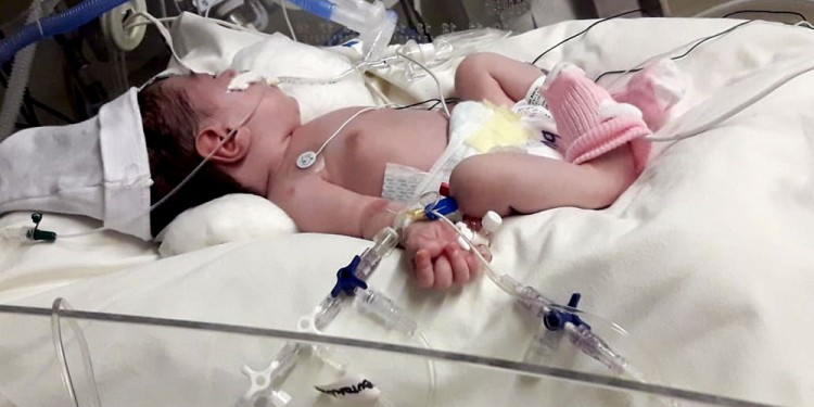 LUCHADORA. La pequeña Selena tiene una cardiopatía congénita y requiere de una cirugía.