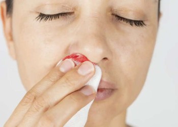 Cómo prevenir el sangrado nasal en el verano