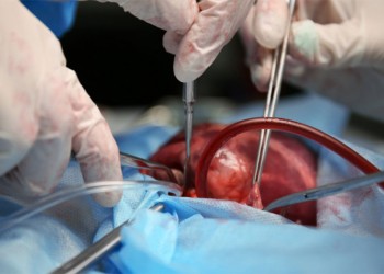 El Hospital Madariaga realizó 9 trasplantes renales en menos de 10 días: una cifra récord