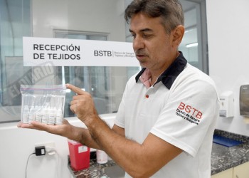 Misiones produjo 160 frascos de gotas oftalmológicas a partir de sangre autóloga