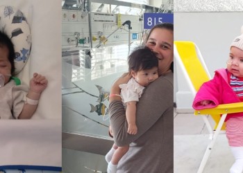 Cardiopatía: bebés evolucionan bien y uno regresa