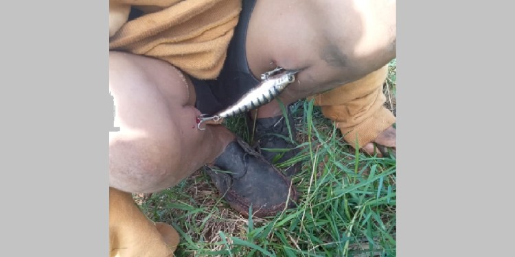 HOSPITALIZADO. El menor habría relatado que estaba armando una cañita de pesca cuando todo sucedió.