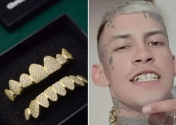 Diamantes y oro para la dentadura, la nueva inversión de L-Gante
