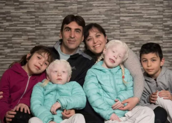 “Misiones es la primera provincia del mundo en tener una Ley de Albinismo”