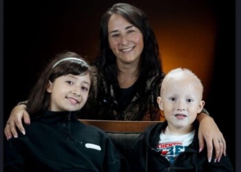 Avanza en Misiones el proyecto de ley para tratar de forma integral el vitiligo