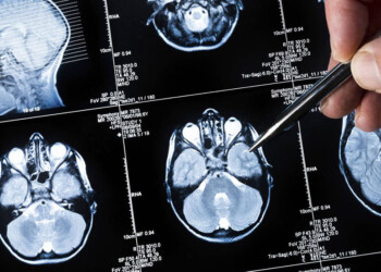 Cerebro y corazón: dos órganos vinculados con factores de riesgos compartidos