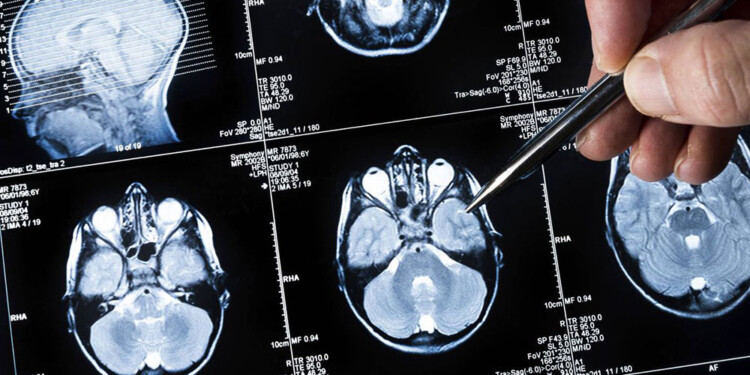 CUIDADOS. Si no hay antecedentes de enfermedades recomiendan consultar al médico una vez por año.