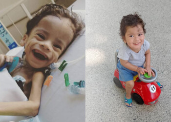 Pequeño gigante: la historia de Máximo y su lucha contra el Síndrome de Berdón