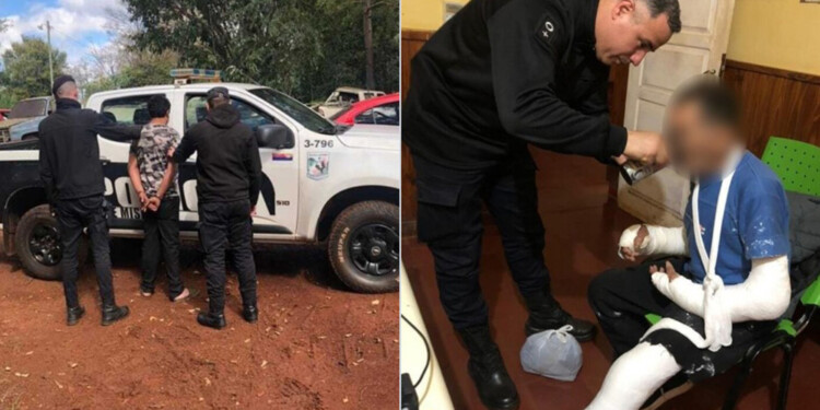 LESIONES. Los médicos estimaron unos 30 días para que sanen las fracturas provocadas por el agresor.