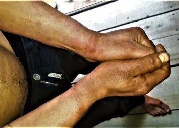 Apremios en Irigoyen: “En un momento les pedí que me maten porque ya no aguantaba”