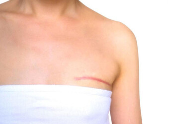 Al año cerca de 30 pacientes se realizan una cirugía de cambio de género en el Hospital