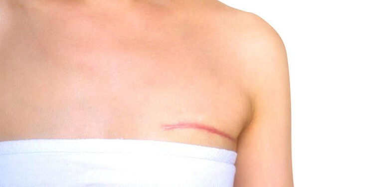 ACOMPAÑAMIENTO. Uno de los puntos que más trabajan los psicólogos con los pacientes que están por someterse a la cirugía es el manejo de las ansiedades y las expectativas.