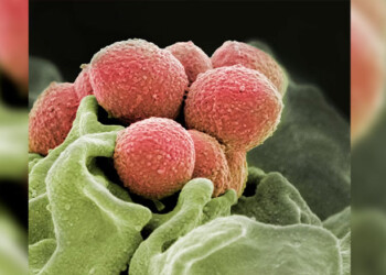 Investigan un clon hipervirulento de la bacteria de la faringitis detectado en Argentina