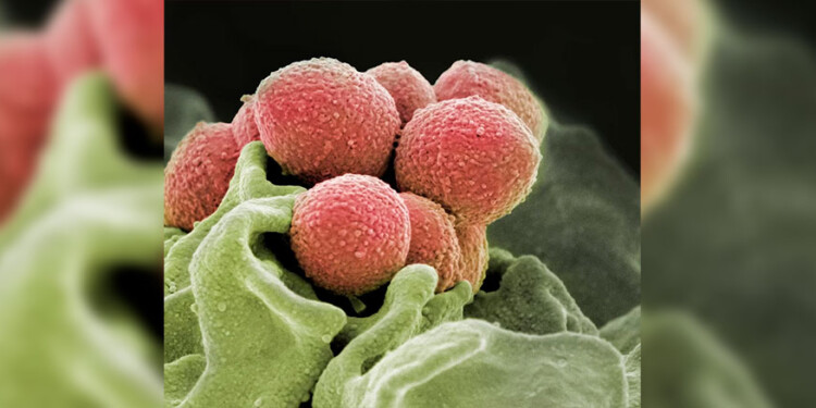 ( NIH National Institute of Allergy and Infectious Diseases (NIAID)