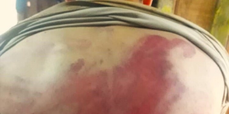 SECUELAS. Intentan establecer como quedó psicológicamente el joven.