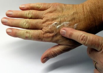 El fotoenvejecimiento en la piel y el factor de riesgo en Misiones