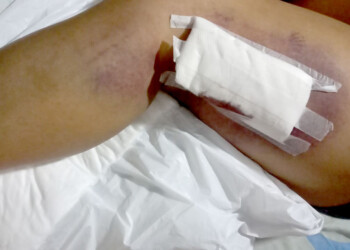 “Tengo miedo que salga y cumpla con sus amenazas de matarme”