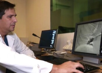 Se realizó en Misiones la primera tromboaspiración pulmonar del NEA