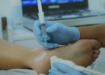 Médicos presentaron la inyección perineural, una nueva alternativa de terapia regenerativa