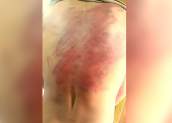 Agravaron la acusación contra los policías de Irigoyen detenidos por golpear a un joven