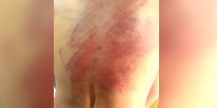 CONTUNDENTES. Las lesiones en la víctima, reflejadas por médicos del hospital.