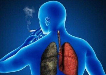 Día contra el Cáncer de Pulmón: advierten aumento de casos en mujeres