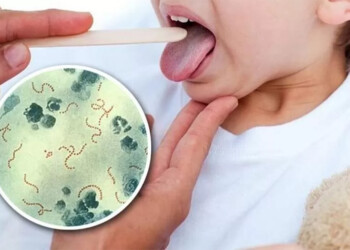 Streptococcus pyogenes: “Las muertes han aumentado muchísimo, casi un 200%”