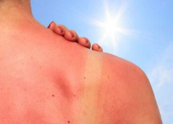 La sobreexposición al sol puede provocar daño en la piel y cáncer