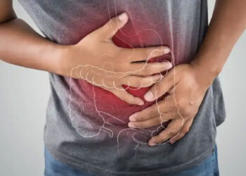 A qué estar atentos ante una posible intoxicación por alimentos contaminados y cómo prevenirla