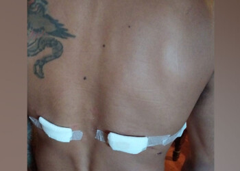 Músico defendió a sus padres de un robo y terminó apuñalado