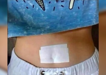 Cuándo bloquear el ombligo