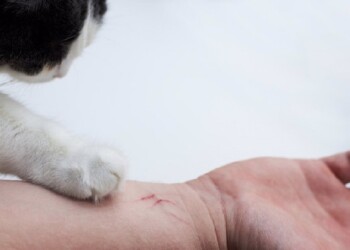 La “enfermedad del arañazo del gato”: ¿sabías que existía?