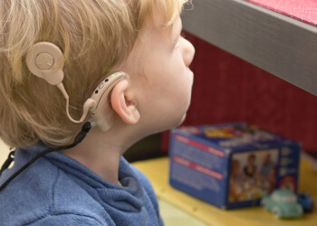 Día Mundial del Implante Coclear: qué es y para qué sirve