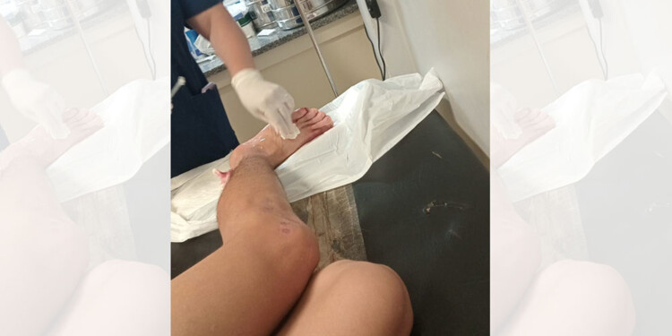 ATAQUE DE PIRAÑA. Recomiendan no ingresar al agua por fuera del horario y zonas habilitadas.