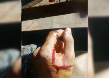 Otro ataque de perros dejó a un joven herido en Misiones