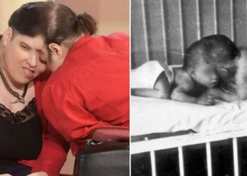 Murieron Lori y George Schappell, los siameses más longevos del mundo