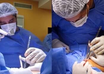 Cómo fue la primera operación de osteogénesis imperfecta que se hizo en Misiones