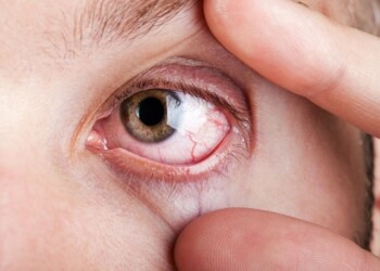 ¿Tenés la vista “cansada”? Estas son las principales causas de fatiga ocular y sus consecuencias