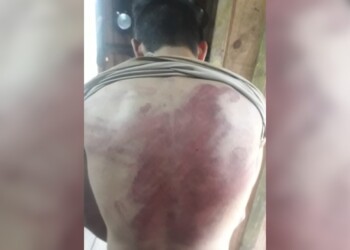 Otro revés judicial para los dos policías acusados de torturar a un joven en Bernardo de Irigoyen