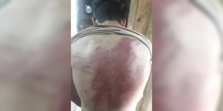 EVIDENCIA. Además de los signos de violencia, su ropa tenía restos de gasoil.