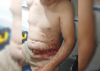 Moto Uber denunció que fue apuñalado por un taxista en Posadas