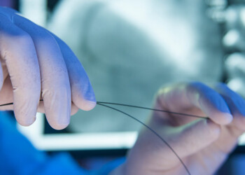 Salud en alerta: ¿no podrán colocarse más stents?