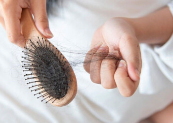 Caída del pelo: ¿un efecto posdengue?