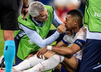 Mbappé se rompió la nariz y es duda para el resto de la Eurocopa