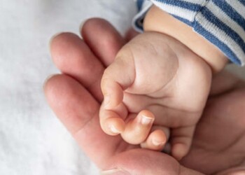 Día del Síndrome de Rubinstein-Taybi: ¿qué es?