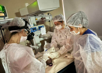 Exitoso procedimiento con láser previno la ceguera de un bebé prematuro