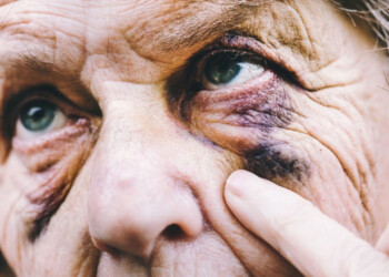 En silencio, suben los casos de violencia doméstica contra adultos mayores